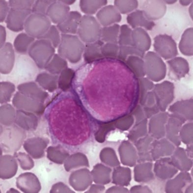Interdisciplinary Research Partnerships Set Out to Uncover the Physics of Cancer