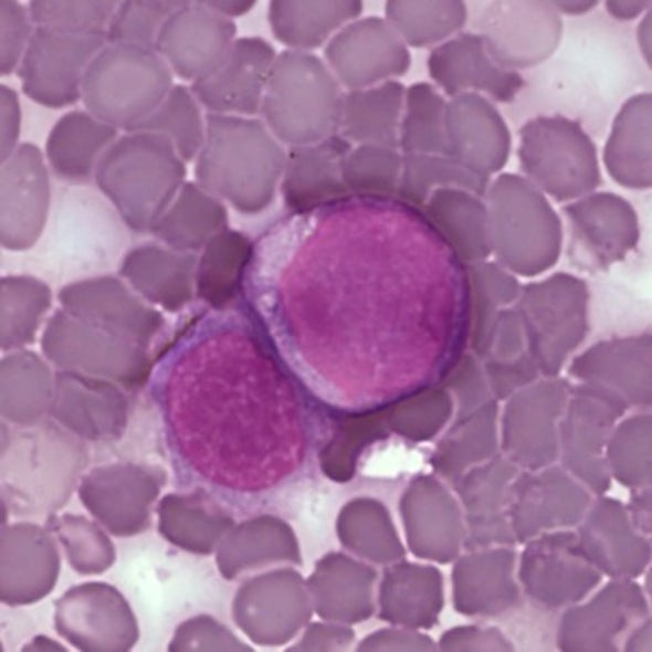 Interdisciplinary Research Partnerships Set Out to Uncover the Physics of Cancer