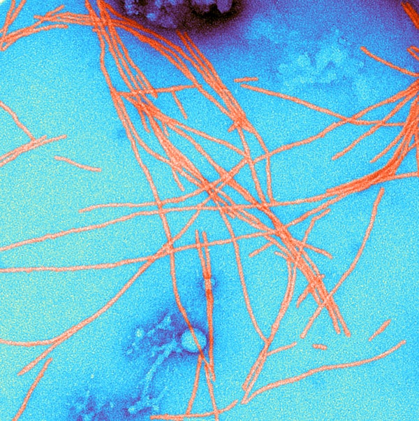 Color enhanced negative stained Transmission Electron Micrograph (TEM) of amyloid fibrils, abnormally folded proteins.