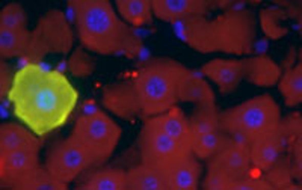 Study Deals Blow to Abilities of Adult Stem Cells