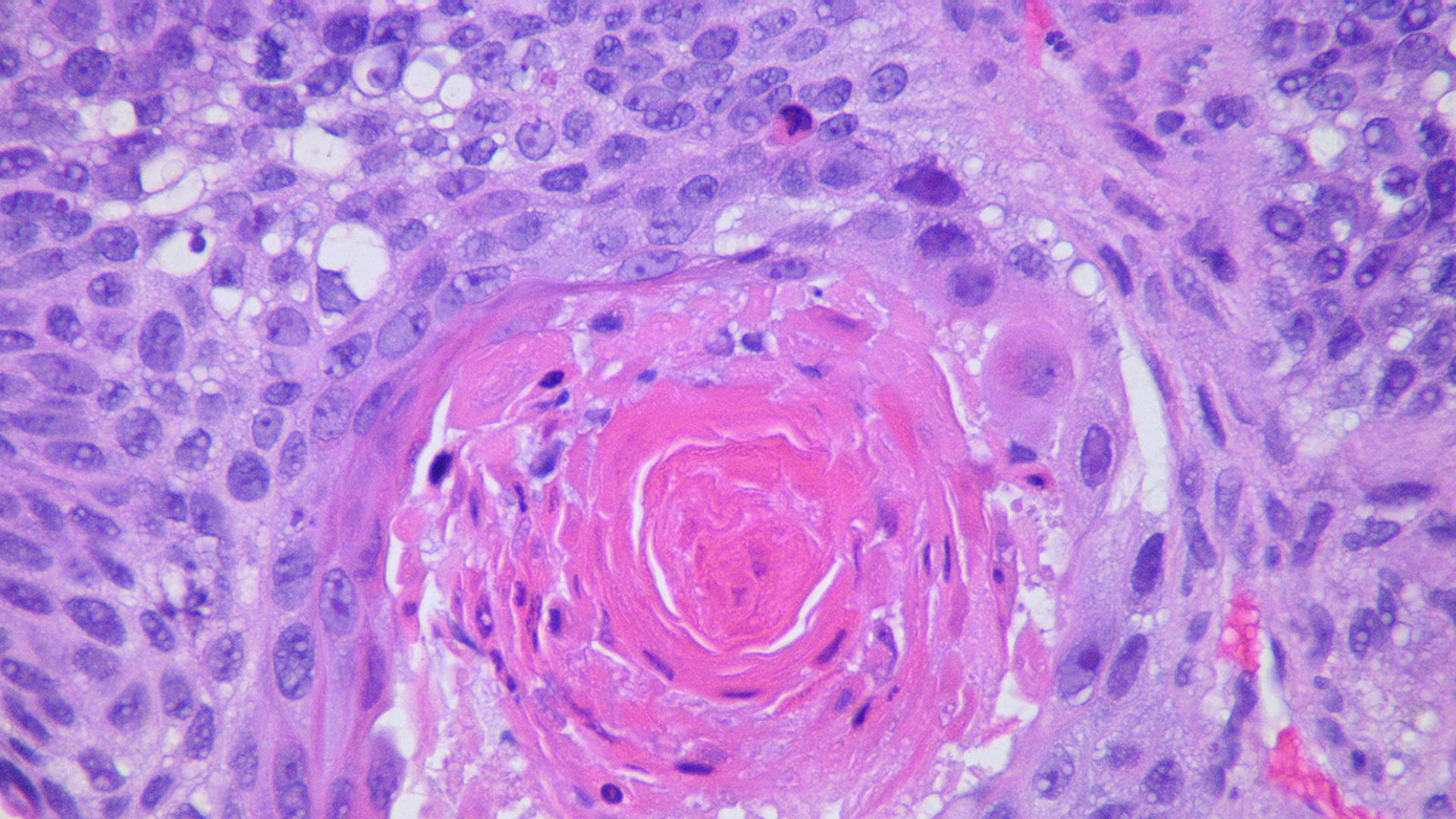 peaka glp 1 liquid pearls Weaponized Antibodies Use New Tricks to Fight Cancer
