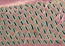 Bundles of Plant-Water-Transportation Cells Resemble Snake Eyes