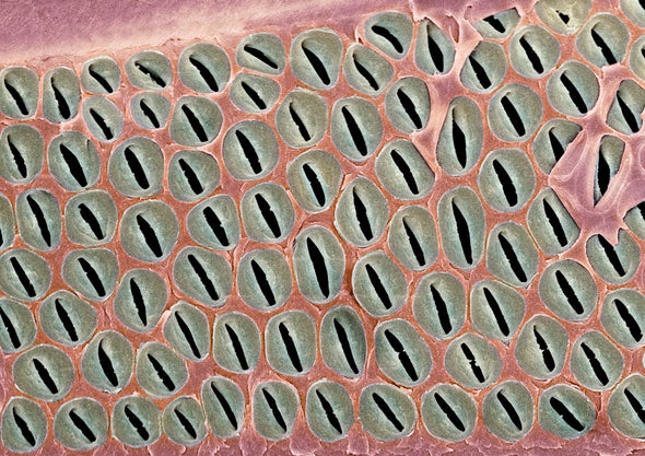 Bundles of Plant-Water-Transportation Cells Resemble Snake Eyes