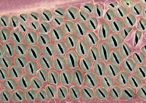 tracheid cells in a sample of softwood
