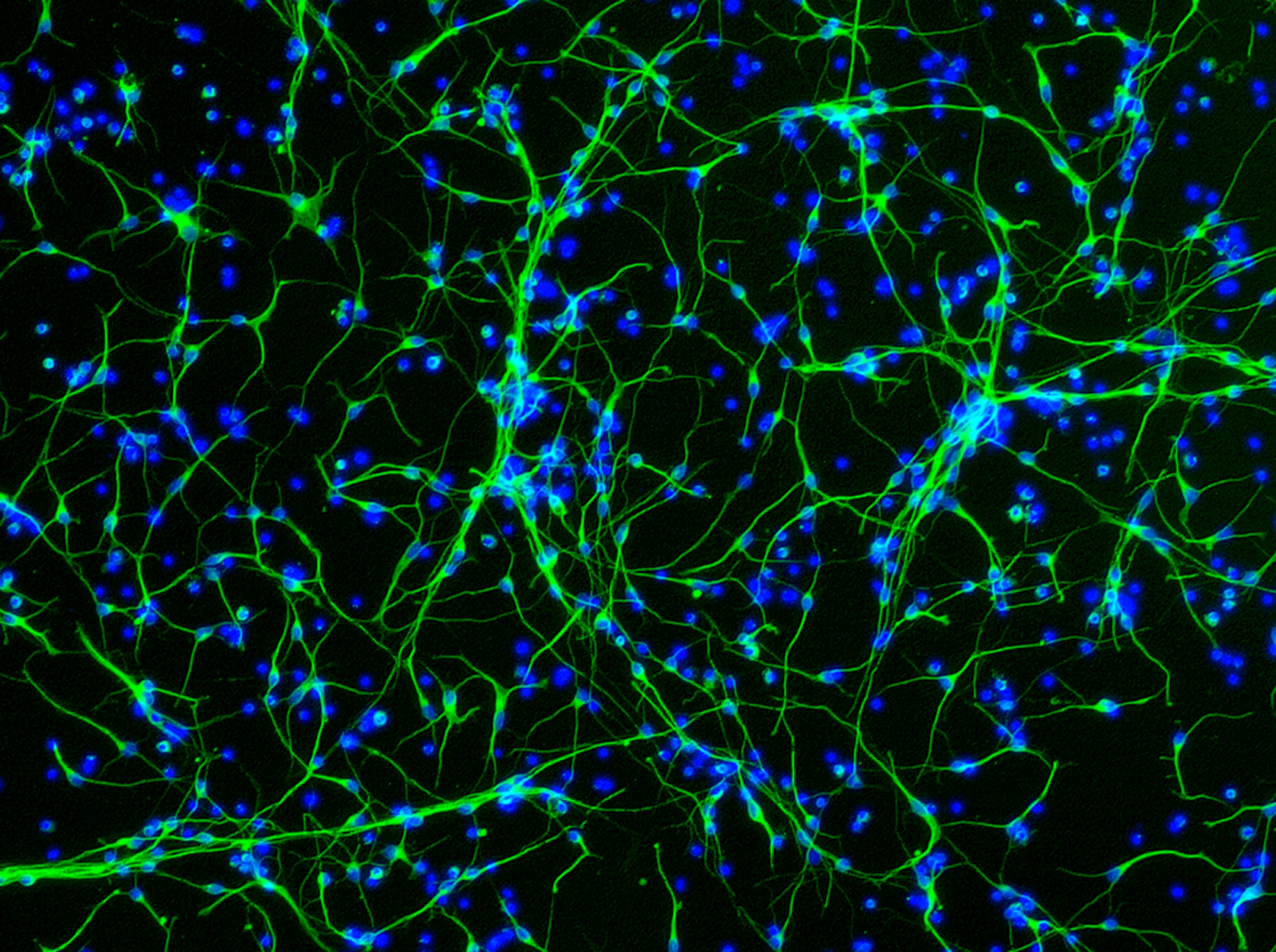 brain neuron connections