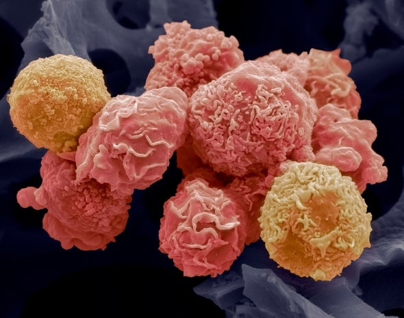 Old Drug, New Tricks: Existing Medicines Show Promise in Fighting Cancer