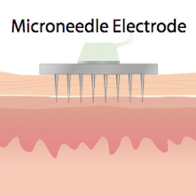 Easier Said Than Done: Using Implants to Electrically Stimulate Paralyzed Vocal Cords