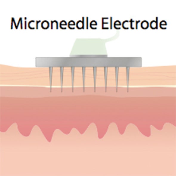 Easier Said Than Done: Using Implants to Electrically Stimulate Paralyzed Vocal Cords