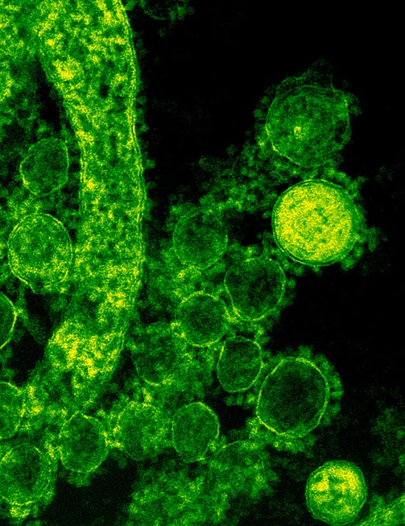 Deadly MERS Camel Virus Crosses Ocean to U.S.