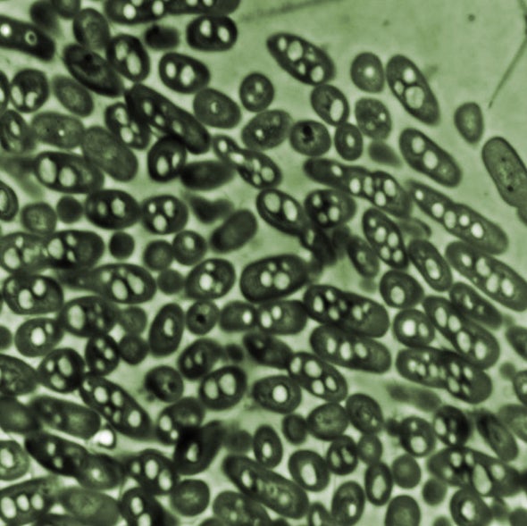 “Bionic Leaf” Makes Fuel from Sunlight