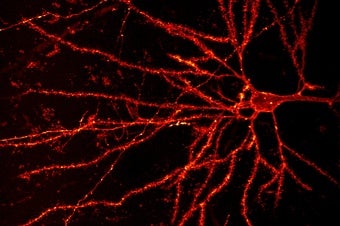 What Makes Human Brain Cells Unique?