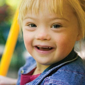 New Drugs May Transform Down Syndrome - Scientific American