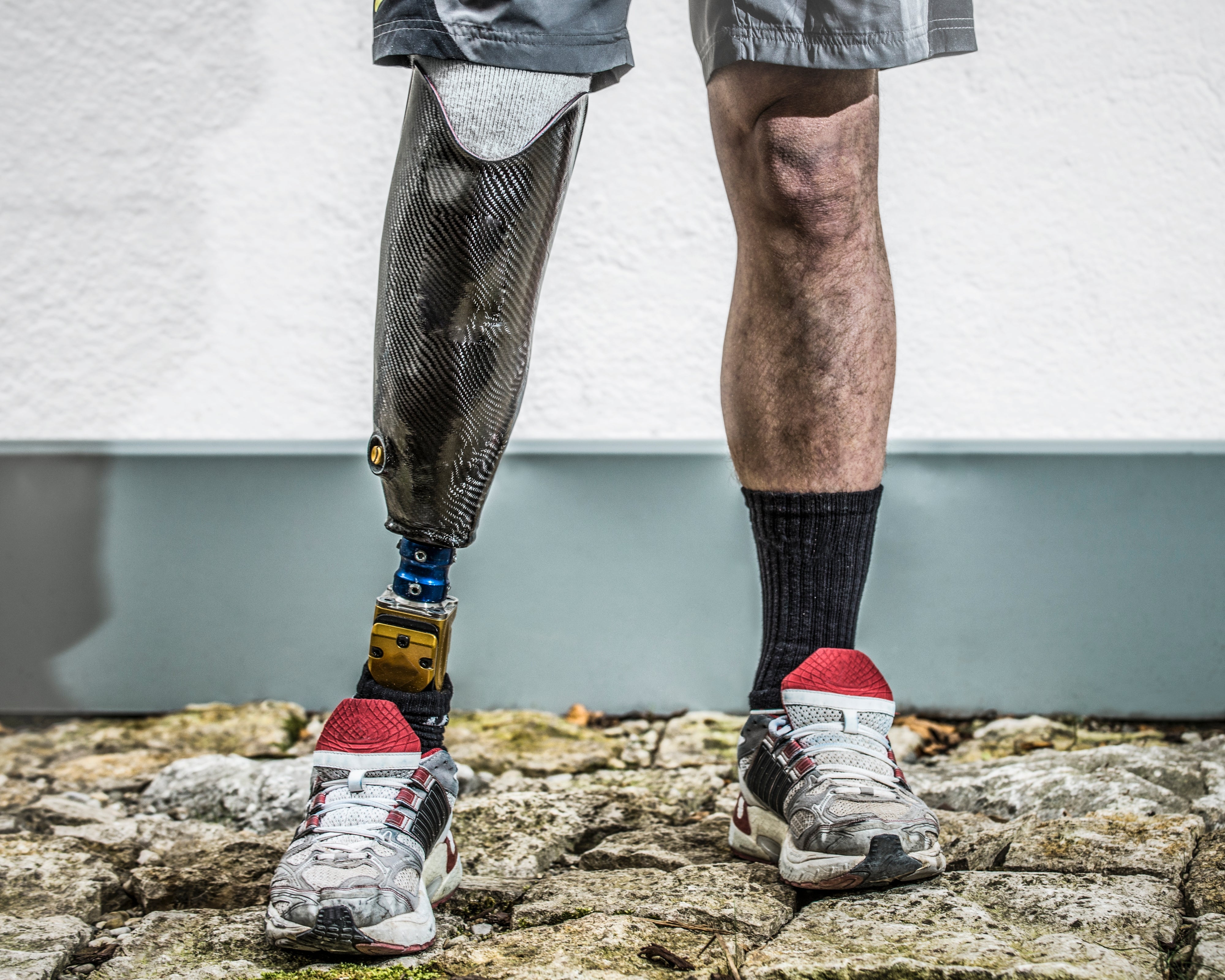 3 Paralympians Describe What It's Like Wearing a Prosthetic Limb