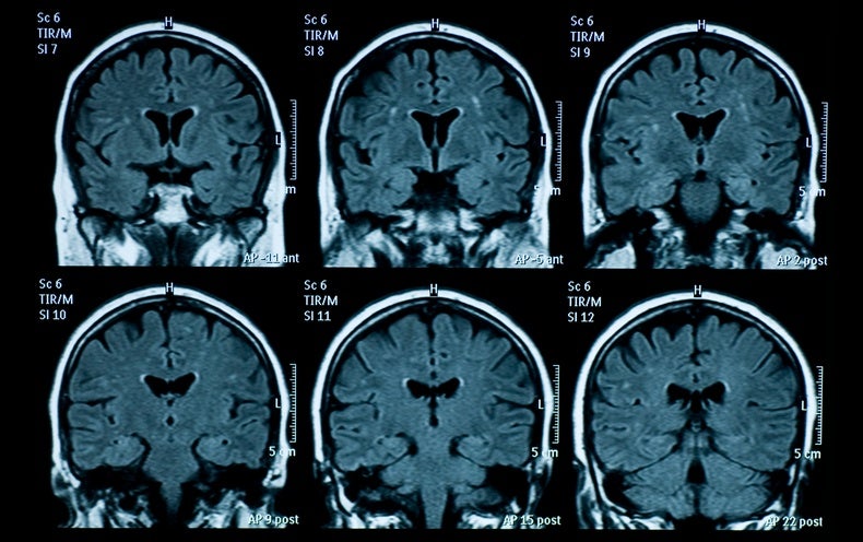 Portable MRI Makes Imaging More - Scientific American