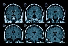 A Portable MRI Makes Imaging More Democratic