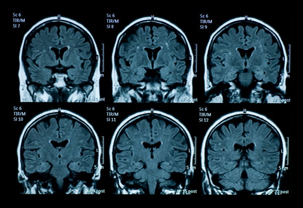 A grid of an MRI brain scan