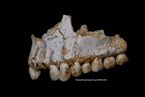 Teeth Hint at a Friendlier Neandertal