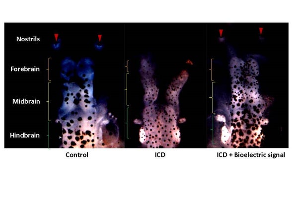 Bioelectrical Signals Can Stunt or Grow Brain Tissue