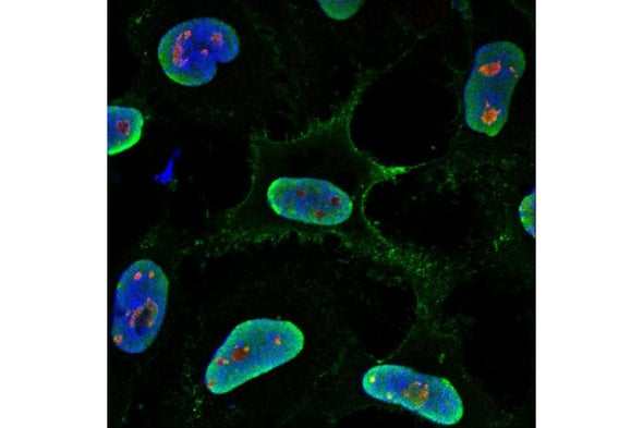 Facing Down the World's Deadliest Pathogens in a BSL4 Lab