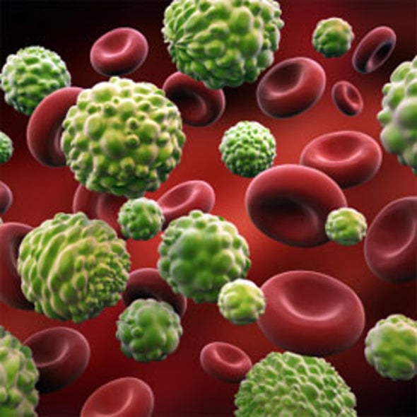 Snap Judgment: Ultrafast Camera Renews Promise of Blood Test for Early Cancer Detection