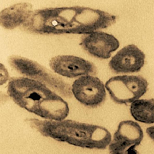 Slick Solution: How Microbes Will Clean Up the Deepwater Horizon Oil Spill