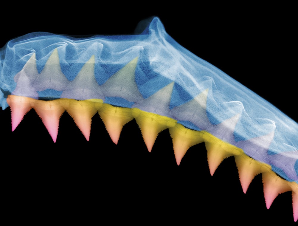 Sharks Never Run Out of Teeth | Scientific American