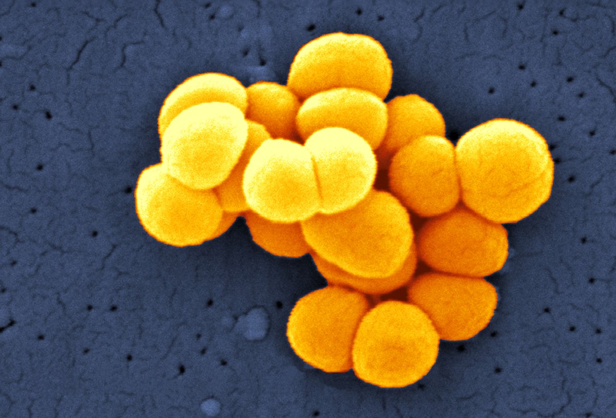 White House Goes Big on Microbiome Research | Scientific American