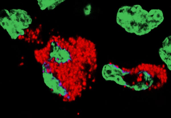Placenta cells infected with Zika virus