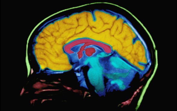 A Brain Deprived of Memory