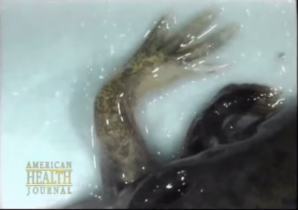 What Salamanders Are Teaching Scientists about How to Regrow Tissue [Video]