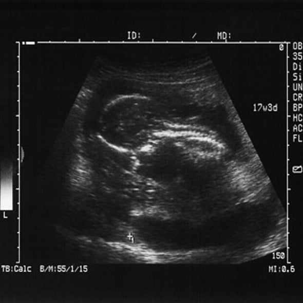 Better Baby-Making: Picking the Healthiest Embryo for IVF