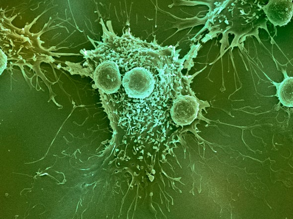 the biology of sugars points to a sweet strategy for treating cancer