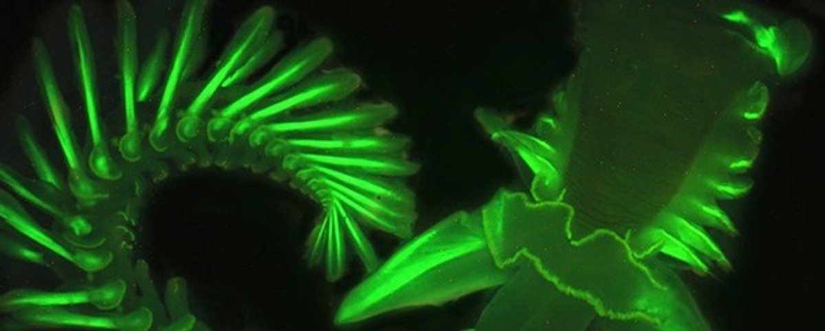 Worm Radiates The Strange Glow of a Common Worm Could Lead to New Medical ...