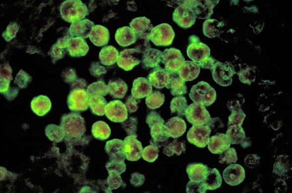 what happens when an amoeba eats your brain scientific american