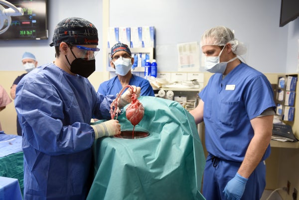 A surgeon holds a pig heart in the operating room.