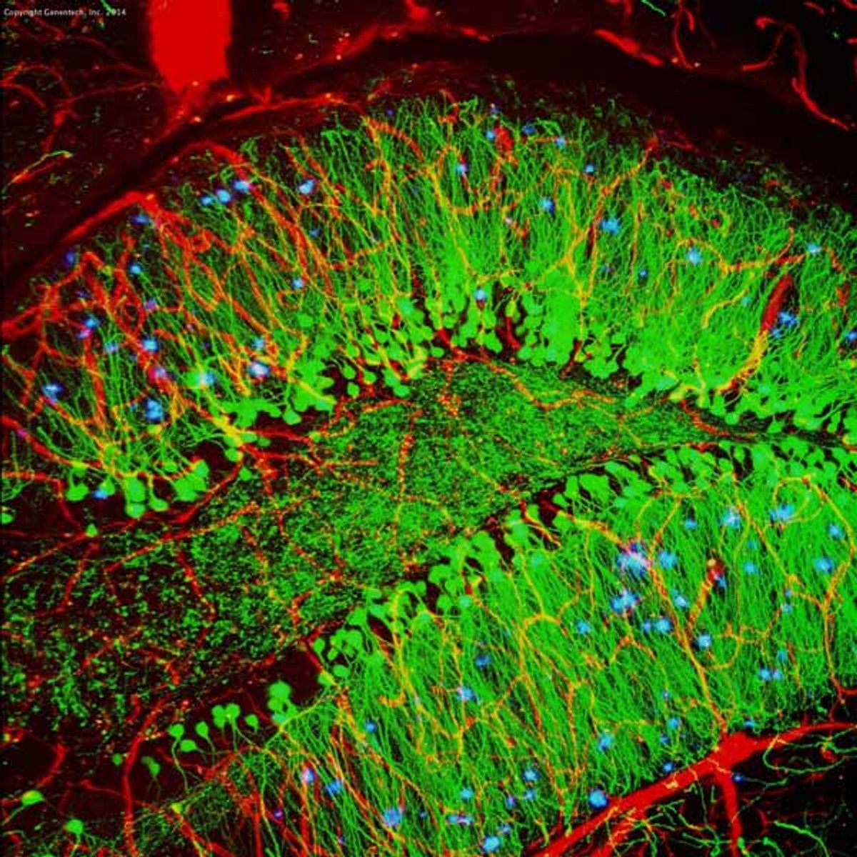 Dulles Airport Shows Beautiful Images of Mouse Brain and Zebra Fish ...