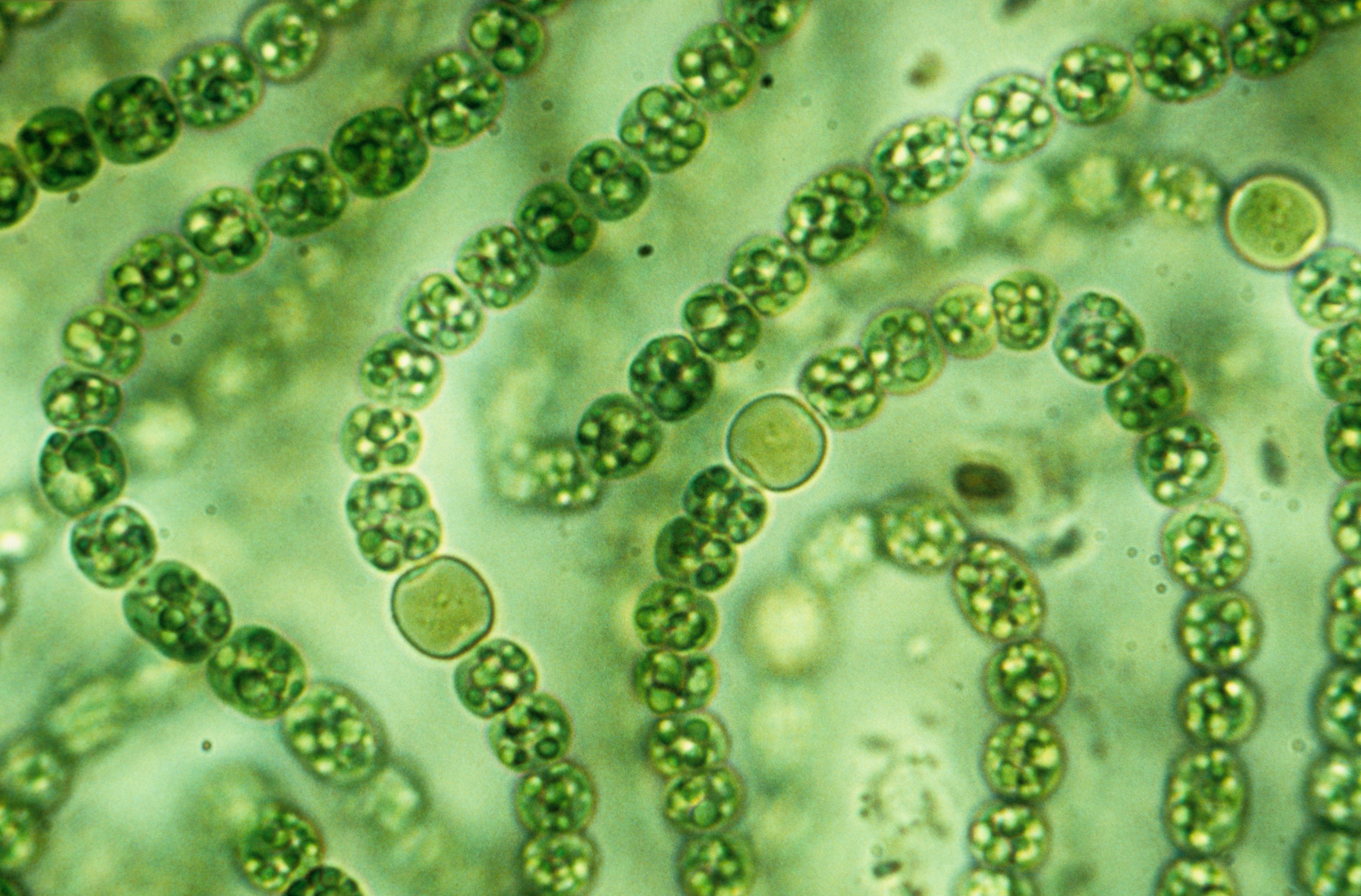 Группы организмов цианобактерии. Цианобактерии носток. Цианеи сине зеленые водоросли. Цианобактерии Архей. Цианобактерии бациллы.