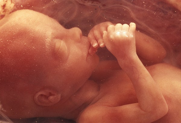 Плод 6 месяцев фото Fetuses May Respond to Faces While in the Womb Scientific American