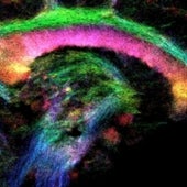 TEXTURED BRAIN