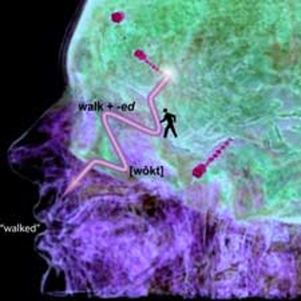 Rare Procedure Pinpoints the Location, Speed and Sequence of the Brain's Language Processes