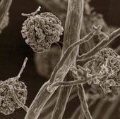 Kidney Glomeruli
