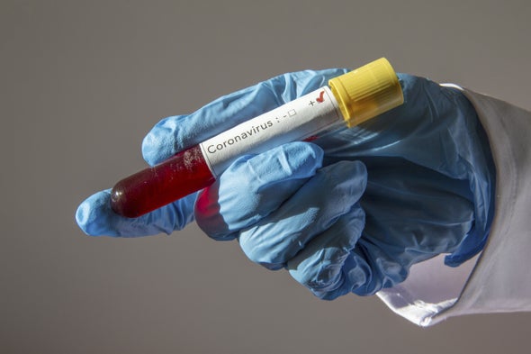 Why History Urges Caution on Coronavirus Immunity Testing
