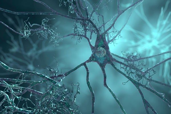 Illustration of nerve cells affected by Alzheimer's disease
