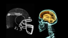 Brain Trauma Scientists Turn Their Attention to Soccer