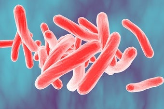 Treatment for Extreme Drug-Resistant Tuberculosis Wins U.S. Government Approval