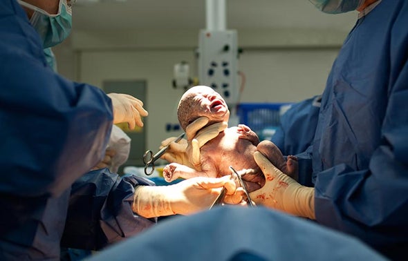 Scientists Swab C-Section Babies with Mothers' Microbes