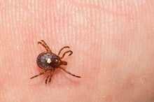 Red Meat Allergy Caused by Tick Bite Is Spreading--And Nearly Half of Doctors Don't Know about It