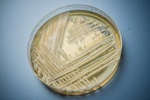 Cases of a Drug-Resistant Fungus Tripled during the COVID Pandemic