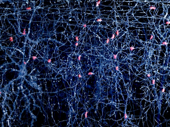 "Bar Codes" Could Map Errant Brain Wiring in Autism and Schizophrenia