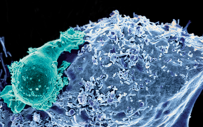 At Cancer's Leading Edge - Scientific American